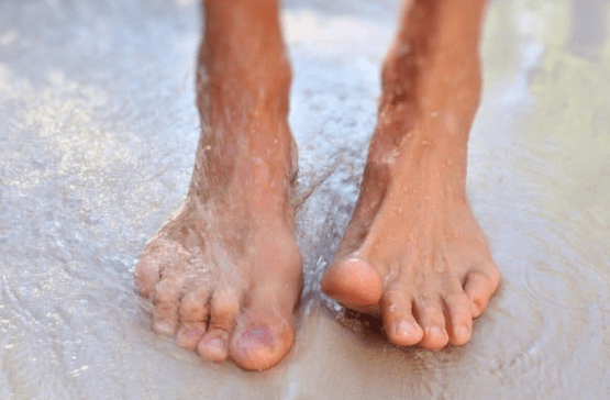 Reasons for the development of mycosis